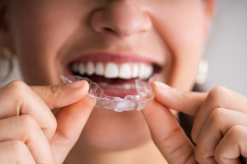 woman smiling and holding night guard up to her mouth