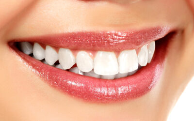 Affordable Cosmetic Dentistry: Smile Makeovers Without Breaking the Bank