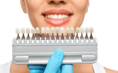 How to Choose the Right Color and Size of Veneers for a Stunning Smile