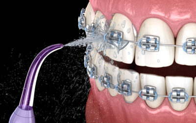 Are Water Flossers Better Than Regular Floss?